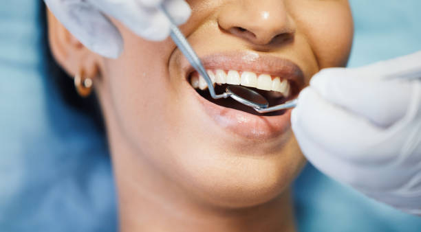 Best Emergency Dental Care for Broken or Chipped Teeth in Hampton Manor, NY